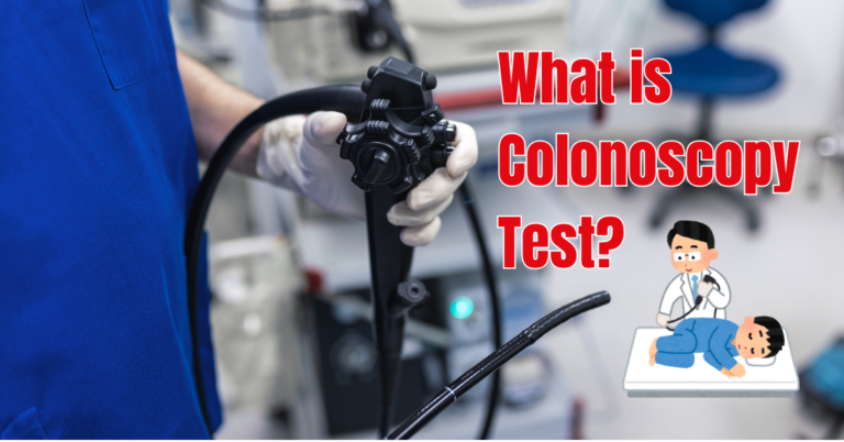 What is a Colonoscopy Test?