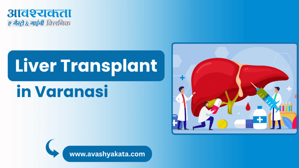 Liver Transplant in Varanasi