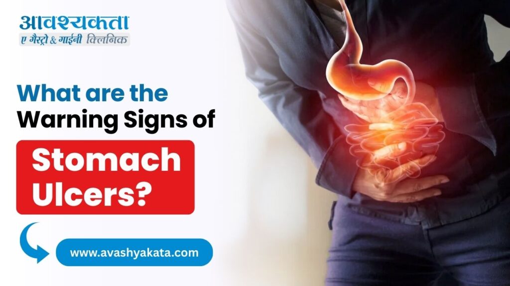 warning Signs of Stomach Ulcers