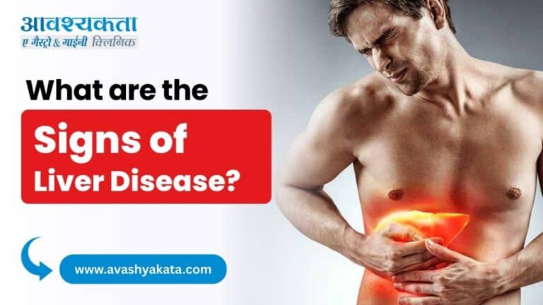 What are the Symptoms of Liver Disease?