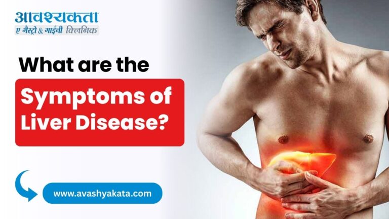 What are the Symptoms of Liver Disease?