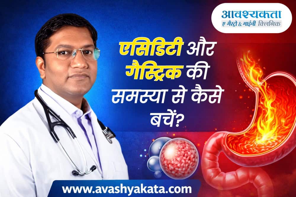 एसिडिटी और गैस्ट्रिक की समस्या से कैसे बचें