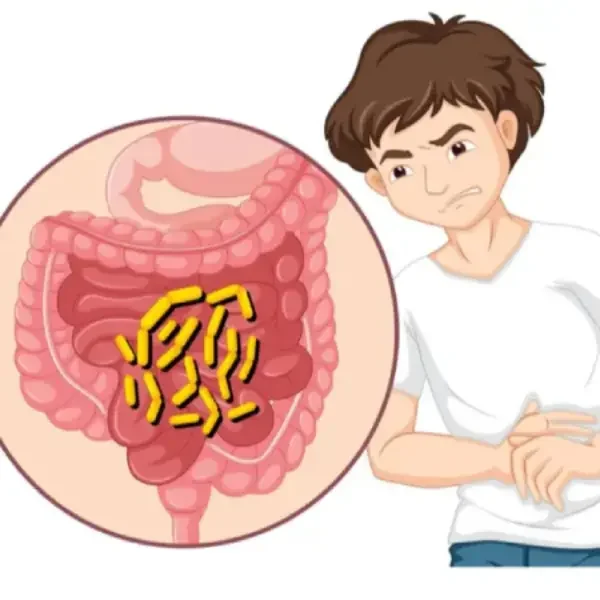 Everything_you_need_to_know_about_Cholera1707909522 (2) Everything_you_need_to_know_about_Cholera1707909522 (2)